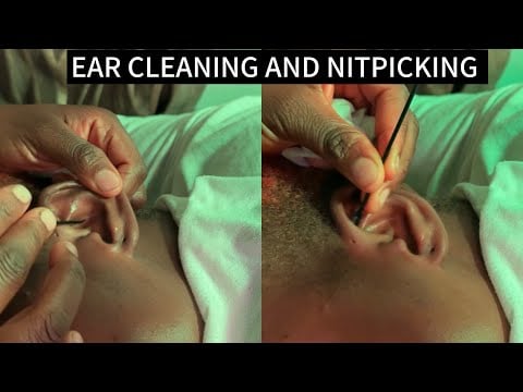 🦋ASMR 🦋RELAXING EAR CLEANING AND NITPICKING FOR THOSE WHO NEED SLEEP IMMEDIATELY VERY TICKLISH