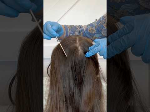 ASMR Scalp Inspection #asmr #comment #community #roleplay #relaxing #satisfyingvideo #sounds #relax