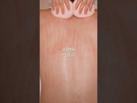 ASMR: RImozione di ACNE e BRUFOLI dalla Schiena! #shorts