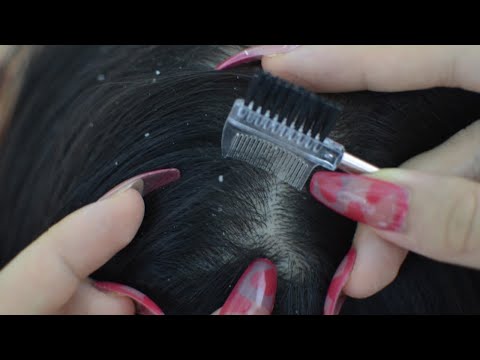 ASMR Scalp Check, Scalp Scratching With Long Nails Make You Fall Asleep ( No Talking )