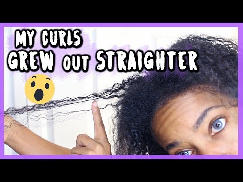 ANEMIA & HAIR LOSS // MY HAIR TEXTURE CHANGED! ⎜MY STORY