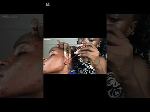ASMR Ear Cleaning, Ear Eating, Ear Licking, Spit Painting, Ear Biting, Scalp Scratching For Sleep