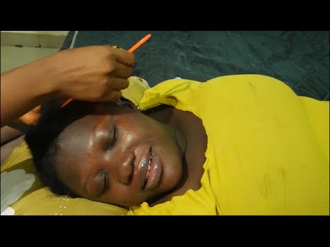 ASMR Fast & Aggressive Scalp Scratching, Gum Chewing for Sleep 😴 ​⁠​⁠@BarciHairASMR