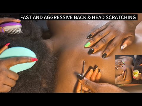 ASMR FAST AND AGGRESSIVE  BACK SCRATCHING AND NITPICKING,HEAD SCRATCHING AND MASSAGE FOR SLEEP