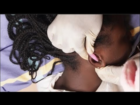 ASMR SATISFYING EAR CLEANING AND PICKING FOR DEEP SLEEP 😴 