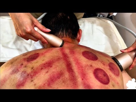 ASMR 🇻🇳 I Wasn’t Ready for This Pain | A Master of Deep Therapeutic Massage
