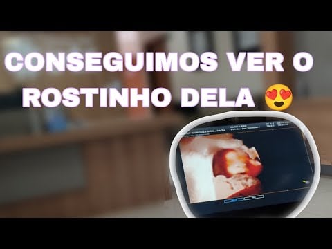 ASMR VLOG: EXAME MORFOLÓGICA DA AURORA + compras no supermercado