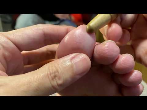 Reflexology Live Streaming