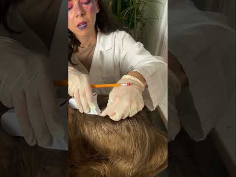 Asmr scalp tingles #asmr #asmrsounds #asmrvideo #relax #relaxing #satisfying #hair #sleep #tingles