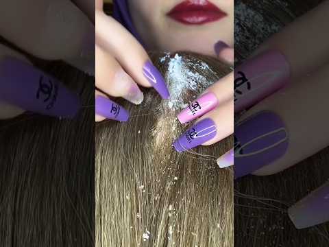 Scalp Scratching & Cleaning 💆🏻‍♀️ #asmr #relax #visualtingle #nails #satisfying #relaxing