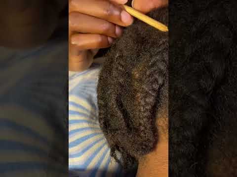 PROFESSIONAL EAR CLEANING ASMR/ SCALPSCRATCHING WITH CHEWING GUM #earpicking #scalpmassage