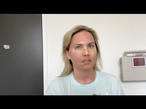 The Most Intense FACE Scraping of My Life - Every Skin Cell Scraped Off