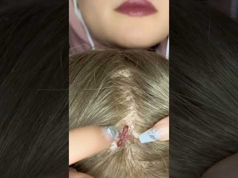Scalp scratching & bugs plucking #asmr #satisfying #visualtingle #asmrmassage #relax #nails #shorts