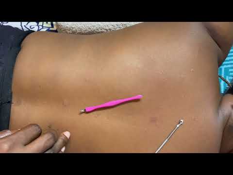 GENTLE ASMR BACK MASSAGE AND SCRATCHING FOR DEEP SLEEP REAL PERSON GUM CHEWING