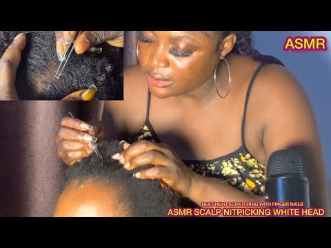 (ASMR)✨ZOOMED, SCALP NITPICKING WHITE HEADS, SUPER INTENSE, BEST HEAD SCRATCHING,