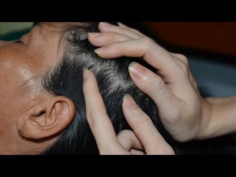 ASMR Scalp Scratching & Scalp Massage, Hair Play For Deep Sleep ( No Talking )