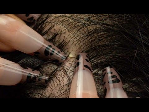ASMR | Rare & Attentive Nitpicking whiteheads | soft whispers 😴