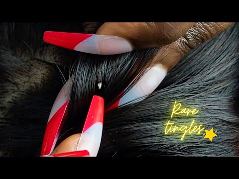 {ASMR} Rare & Specific Nitpicking Whiteheads triggers | ALL SUPER-ZOOMED