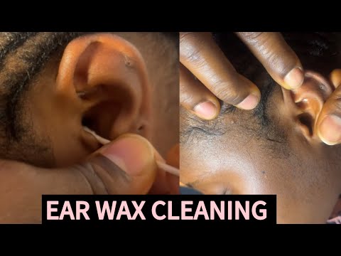 ASMR PROFESSIONAL EAR CLEANING AND PICKING FOR THOSE WHO NEED SLEEP NOW