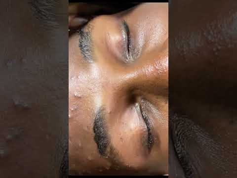ASMR FACE NITPICKING AND MASSAGE FOR RELAXATION #asmr #tingling #relax #satisfying