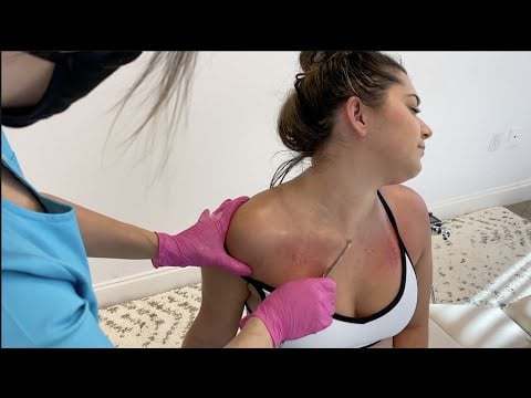 The BEST FEELING EVER! First Time Having Her Back CRUNCHED by a Chiro - Relaxing with Tingles