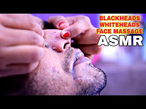 Nose Blackheads Extracted | Nose whiteheads removal | ASMR Face Massage