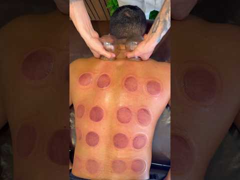 "ASMR" cupping alinezhad😍❤️#shorts #asmr #relaxing #youtubeshorts