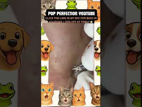 Wow! #pimpleremoval #pimple #pimples #shortsfeed #shortvideo #shorts #short #youtube #youtubeshorts