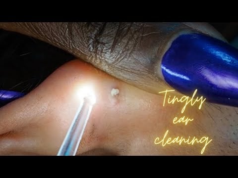 {ASMR} Super Tingly Ear Picking & Cleaning 😬😴 | Allzoomed
