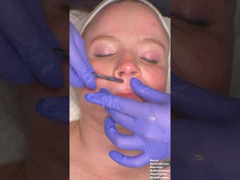 ASMR Glowy Dermaplaning Facial