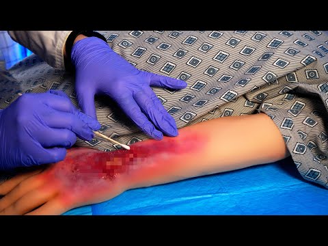 ASMR Hospital Incision & Drainage | Fabric sounds, Visual ASMR | Medical Role Play