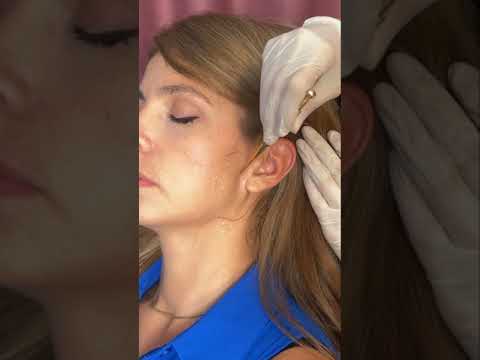 Asmr ear 👂 exam #asmr #relax #relaxing #asmrsounds #asmrvideo #tingles #medical #satisfying #sleep