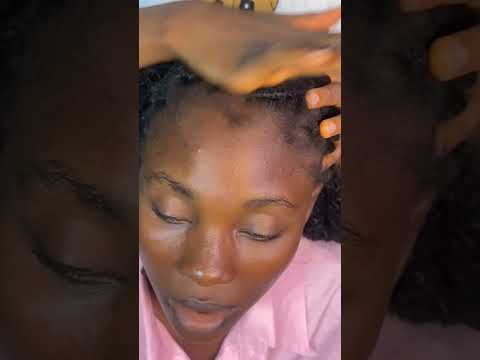 ASMR AGGRESSIVE HAIR SCRATCHING MASSAGE AND HAIR PULLING VERY ITCHY SCALP WITH OILING|