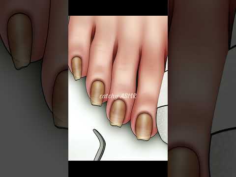 Toenail care ASMR, Healthy nail trim animation, Relaxing ASMR animation.