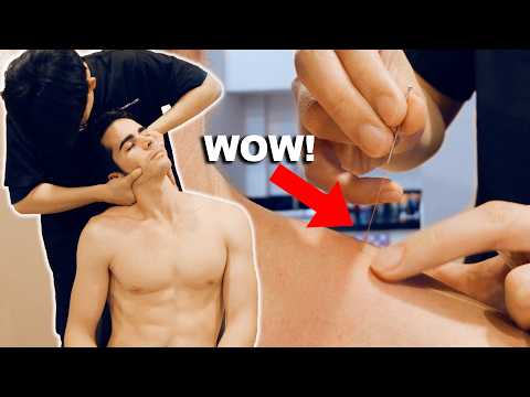 ASMR: Chiropratico Sistema i miei Dolori al Collo e Schiena con CRACK e AGOPUNTURA! Ep. 4