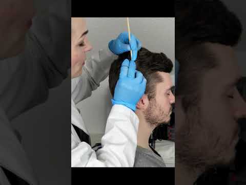 Scalp Examination & Check Up [ASMR] #Shorts