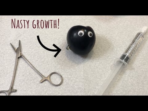 [ASMR] Surgery On Plum