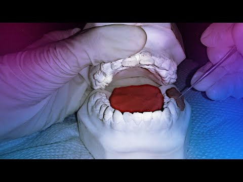 ASMR: ROLEPLAY REMOVENDO ÀS SUJEIRAS DO SEUS DENTES.(DENTISTA)