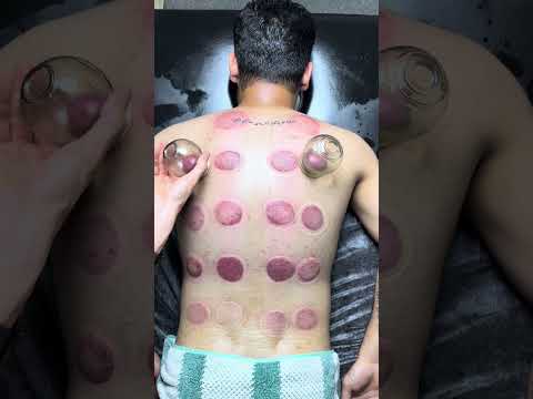 "asmr" cupping alinezhad❤️#shorts #asmr