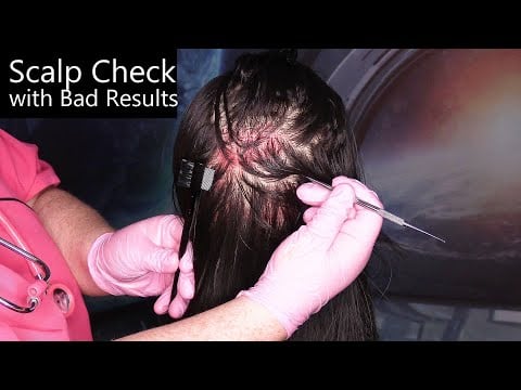 ASMR Scalp Check with Bad Results (School Nurse Lice Check, Scalp Massage) Medical Roleplay
