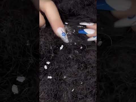 Hair Cleaning - dandruff #asmr #relax #visualtingle #satisfying #relaxing #tingles