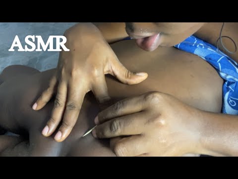 ASMR✨TOOTH PICKING HER TINY BACK PIMPLES VERY RELAXING