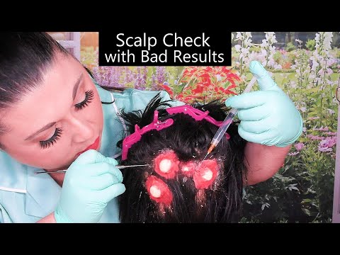 ASMR Scalp Check with Bad Results (Acne Removal, Scalp Treatment, Whispering) Medical Roleplay