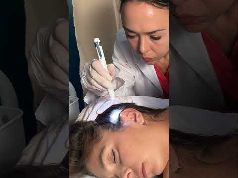 Asmr scalp tingles #asmr #asmrsounds #asmrvideo #relax #relaxing #satisfying #hair #sleep #tingles