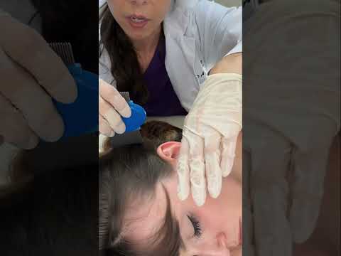 Asmr scalp tingles #asmr #asmrsounds #asmrvideo #relax #relaxing #satisfying #hair #sleep #tingles