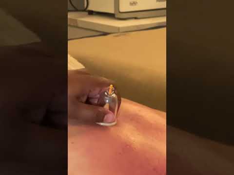 Masaje desinflamatorio #spa #caracas #venezuela #massage #relax #short