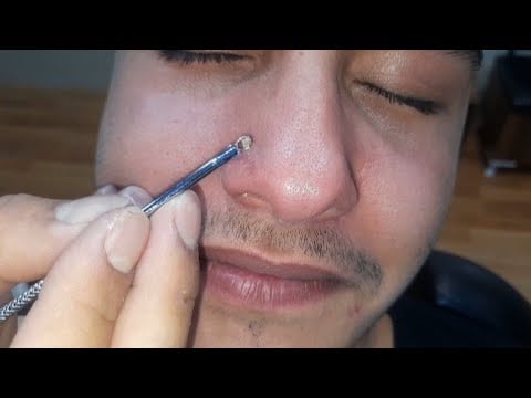 Perfect blackhead removal and acne removal skin care asmr massage
