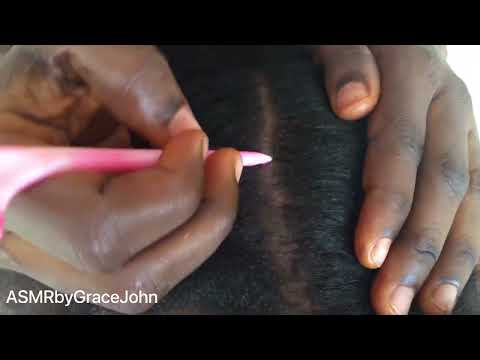 Asmr My Friend Scratching My Scalp and It’s Triggers Me To Sleep. #asmr #scalpscratching #sleepasmr