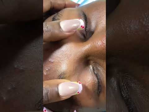 ASMR FACE NITPICKING AND CLEANING #asmr #satisfying #relax #asmrvideos