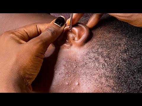 Asmr Super Attentive deep ear cleaning